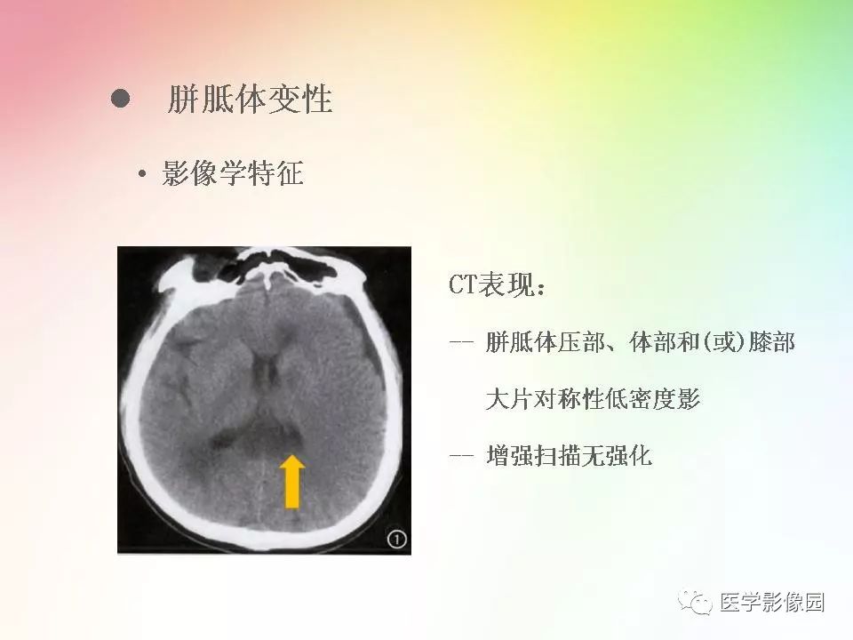 胼胝体病变影像学表现影像天地