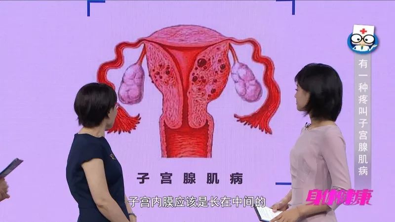 子宫腺肌病