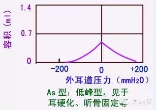 a型:正常型,即峰压点位于±50pa之间,峰值0.3-1.65ml,儿童则为0.35-1.