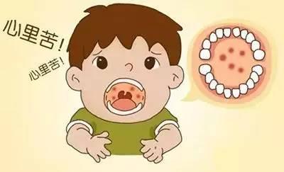 小儿口腔溃疡怎么办?该如何缓解小儿口腔溃疡?