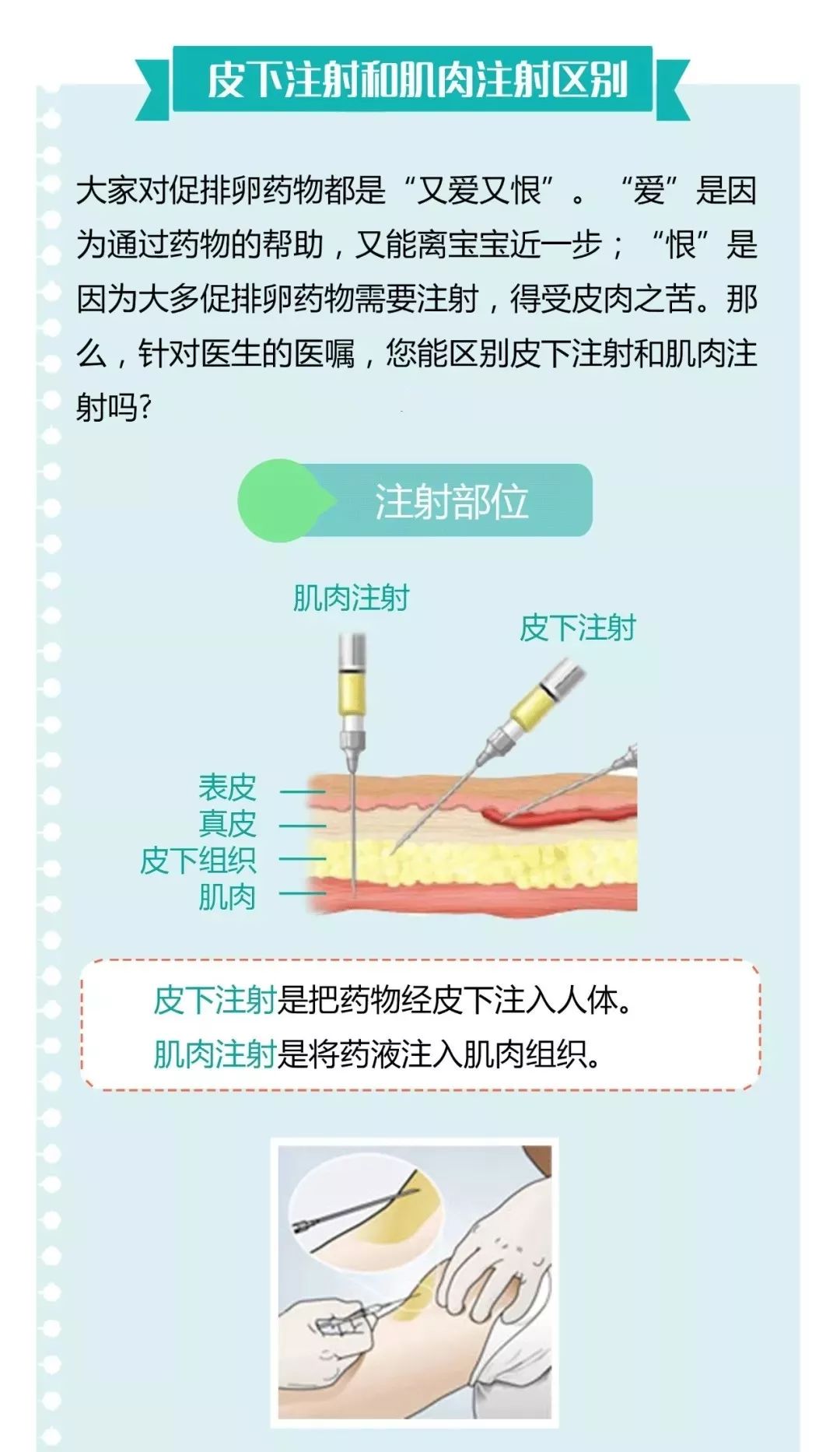 打促排卵针,皮下注射和肌肉注射有什么区别?