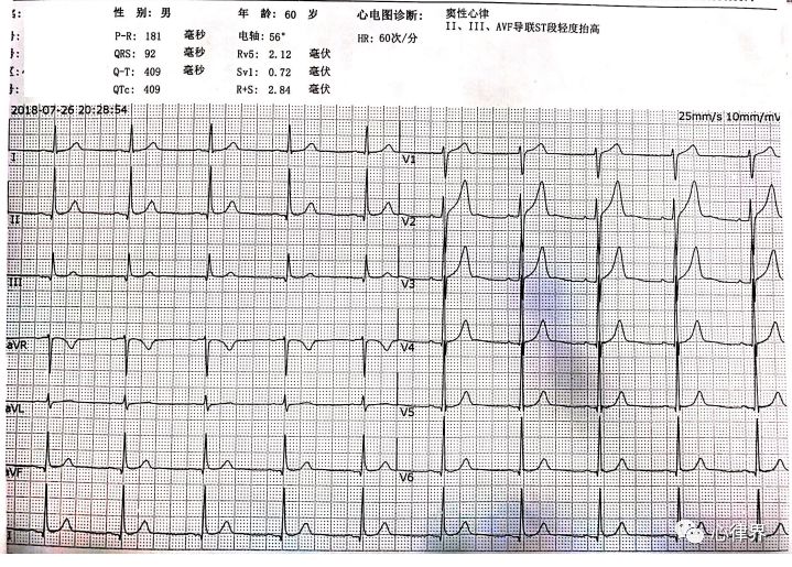 病例分享〡心脏停跳,谁是凶手 江苏省人民