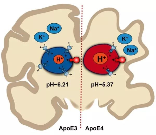 阿尔茨海默氏症的一个原因可能是胞内体简单的酸碱(或ph值)化学不平衡