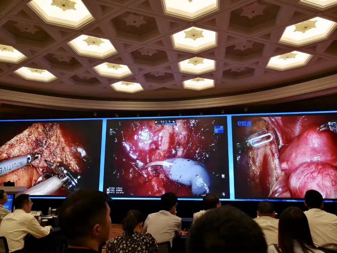 瑞金胸外团队受邀参加srs 2018亚洲年会手术演示及专题讲座