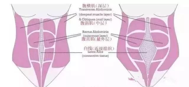 产后恢复别忘了你的腹直肌