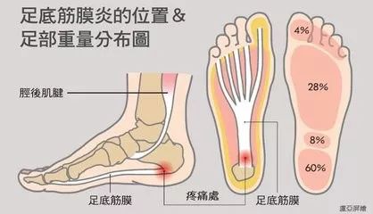 脚心痛怎么办