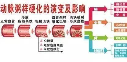 血管堵塞带来严重的健康伤害,你知道多少?