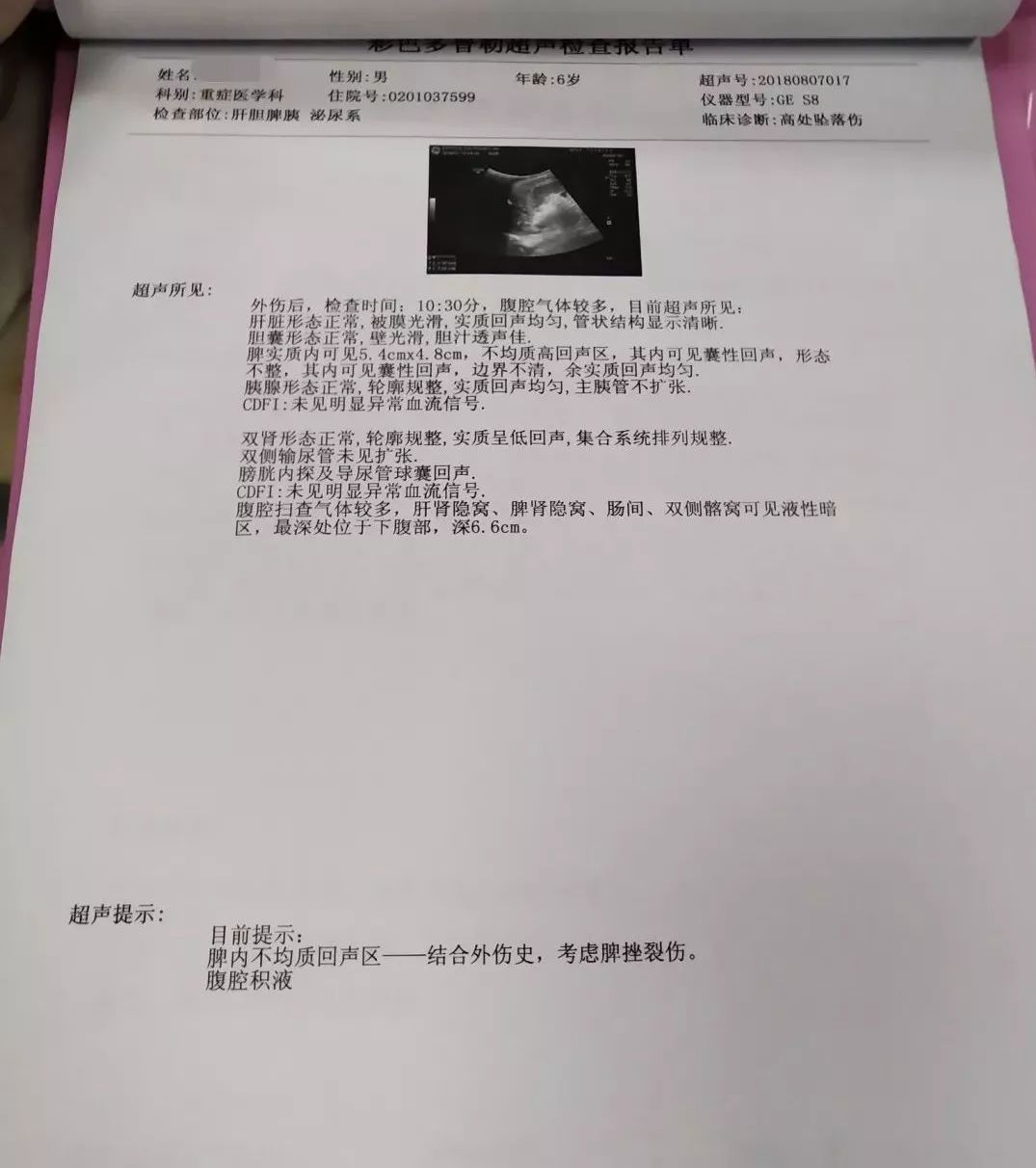 腹部彩超示:脾内不均质回声区(考虑脾挫伤)脾周积液,腹腔积液.