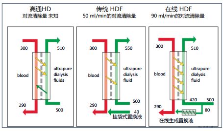 血液透析滤过是什么原理_血液透析滤过的原理图(2)