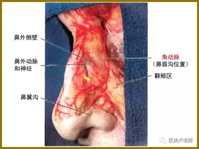 颧颊区-唇的边界是鼻唇沟,其深面是面动脉面部各面区之间和脂肪室之间