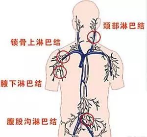 脖子上淋巴结肿大,医生说是免疫力低下,我该怎么做?