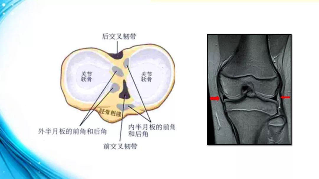 膝关节解剖(一)