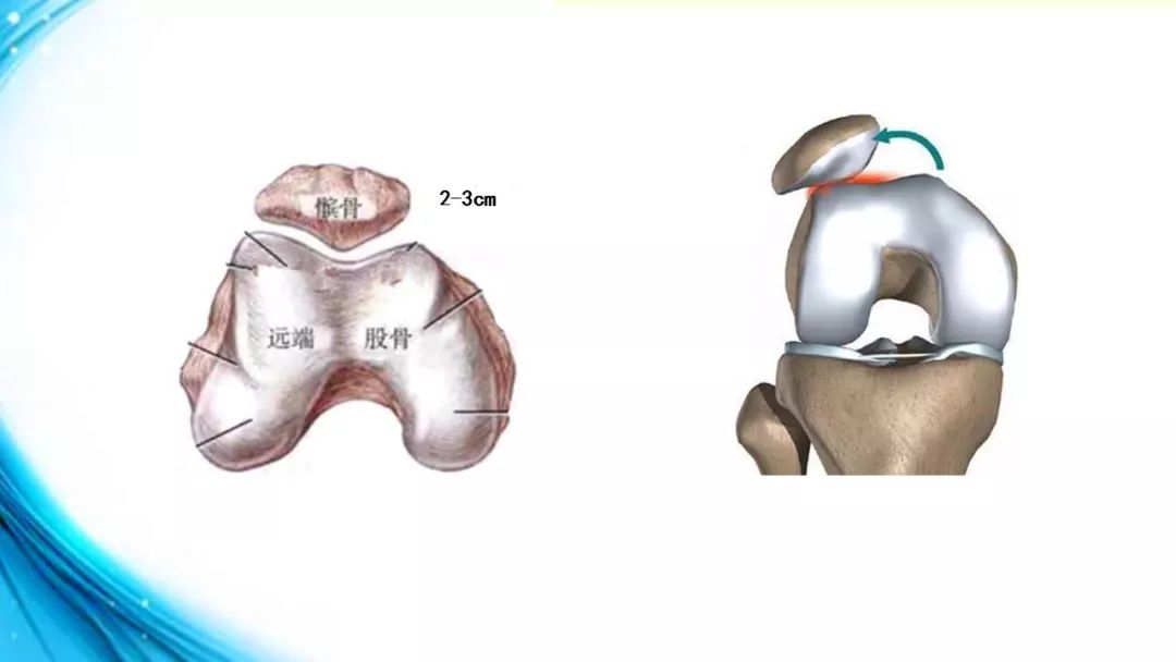 膝关节解剖(一)