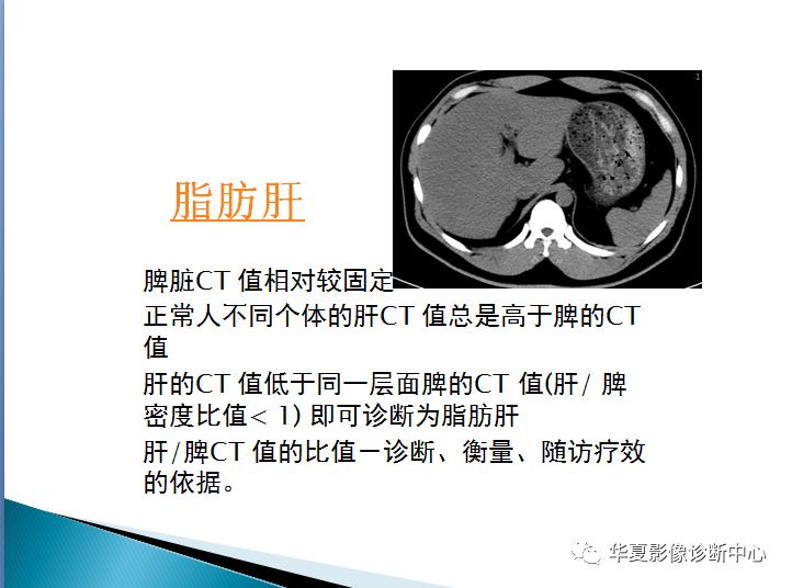 脂肪肝的各项影像学定性定量诊断