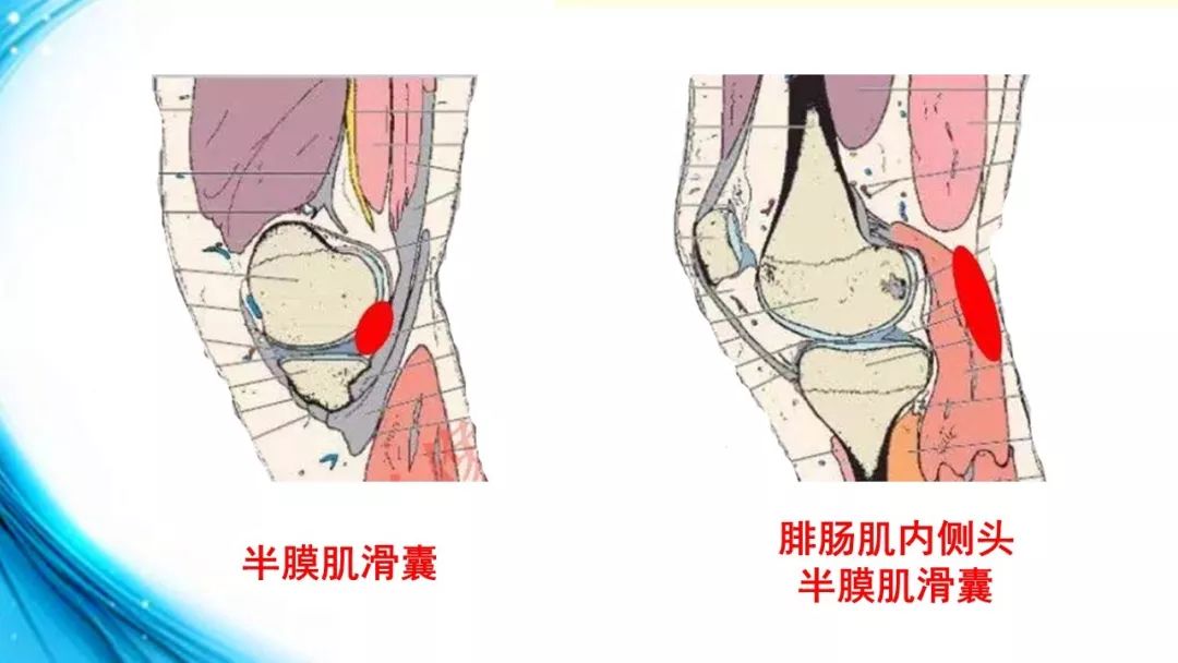 膝关节解剖(二)_韧带