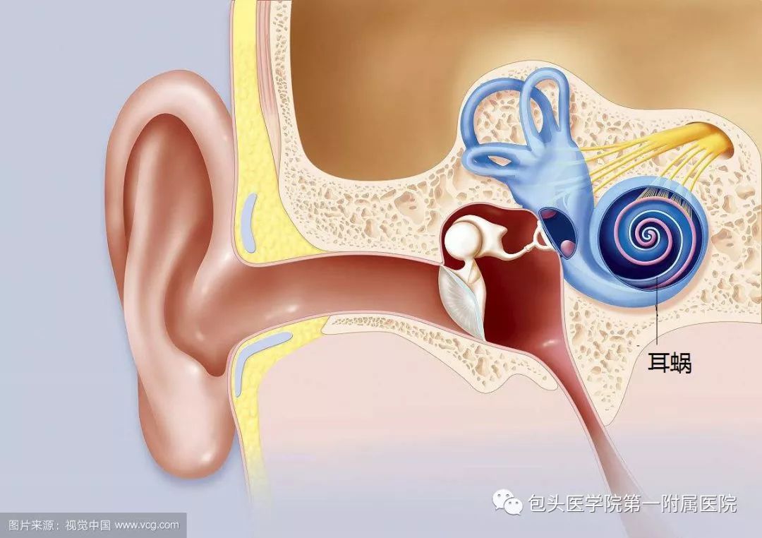 耳朵分成三部分:外耳,中耳和内耳;耳朵的结构什么是人工耳蜗?