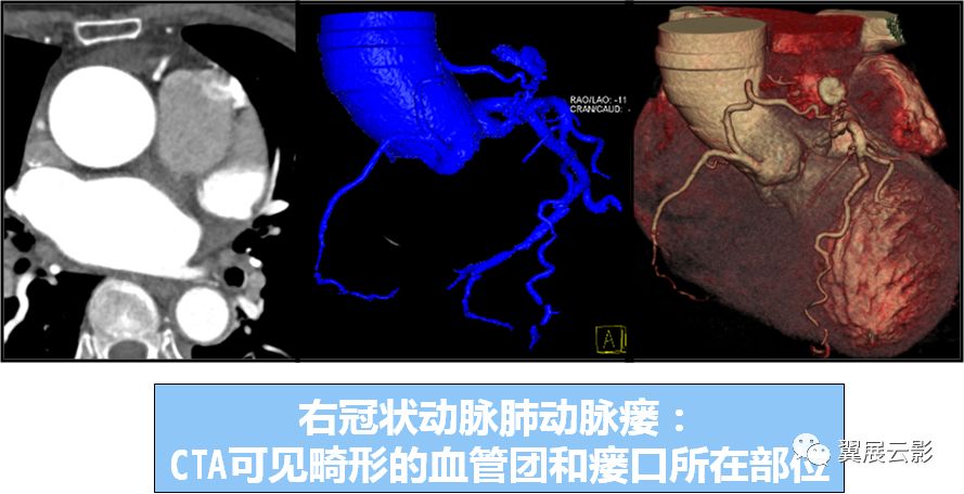 比如支气管动脉,内乳动脉,心包动脉,前纵隔动脉,膈上动脉和膈下动脉