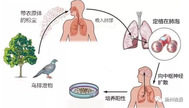 老年人口呼吸矫正_牙齿矫正图片