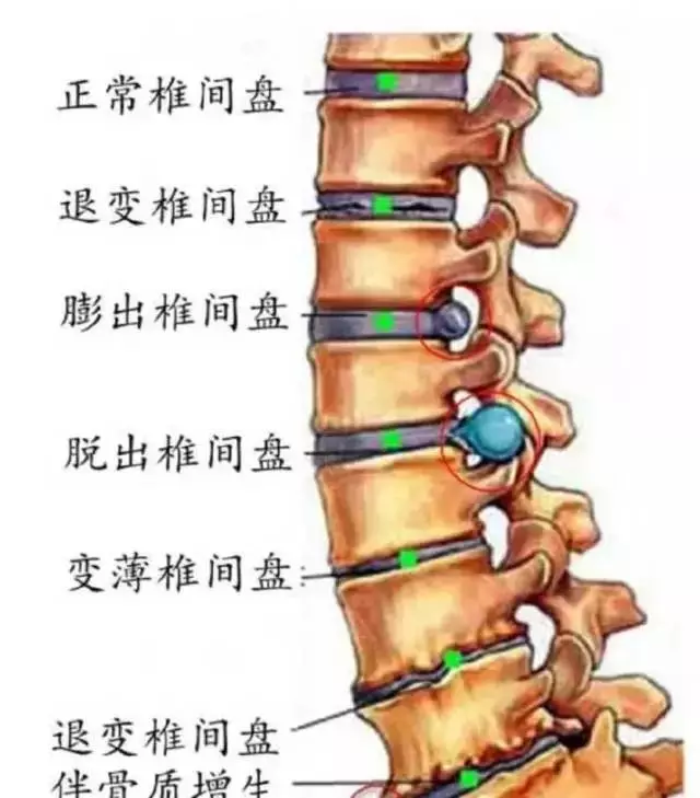 颈椎病究竟是怎么得的,看了这篇文章你就知道了!