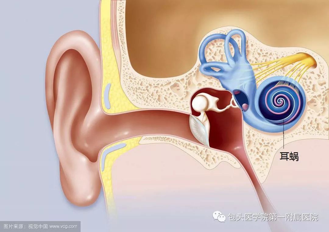 包头听力障碍患者的福音!这家医院正式开展人工耳蜗植入手术啦!
