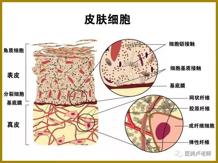 一般增生性疤痕解析