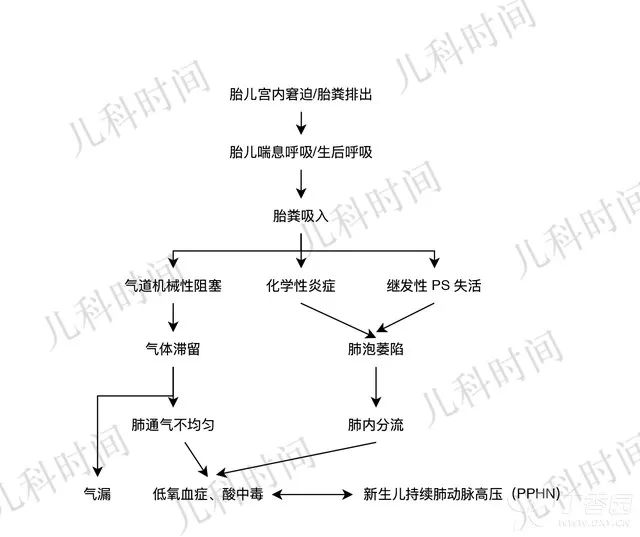 胎粪吸入综合征(mas)是胎儿在宫内或分娩时吸入混有胎粪的羊水,导致