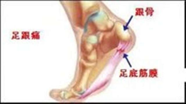 人口手足_人口手足