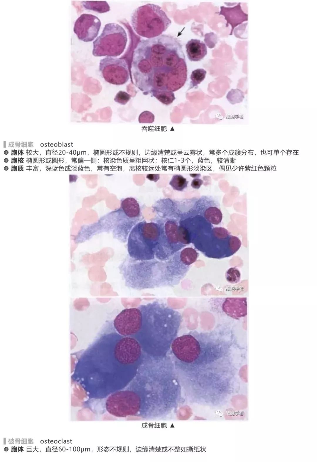 出自《血细胞图谱》[著] 三轮史朗(日)颗粒细胞电子显微镜下形态模