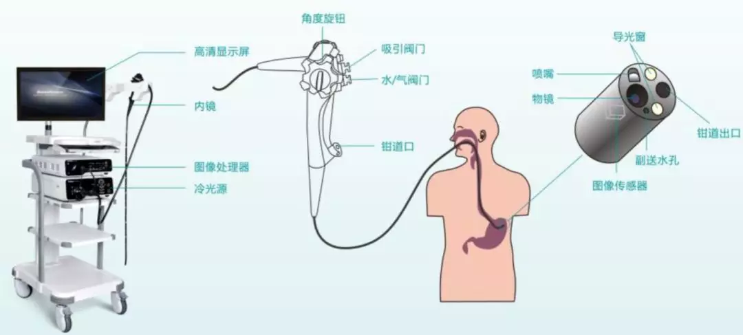 内窥镜微创医疗器械主要由医用内窥镜,内镜手术耗材和配套设备构成.