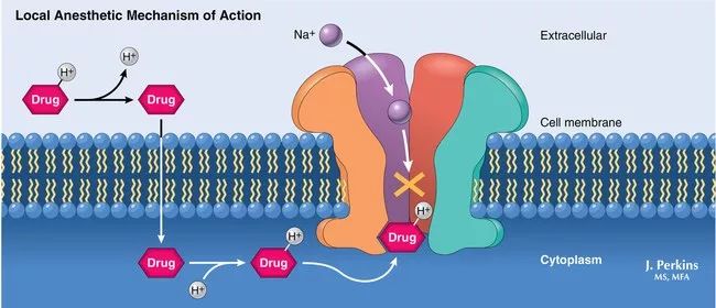 当局麻药渗透进去后,局麻药结合到神经细胞膜上的钠通道上,钠离子通道