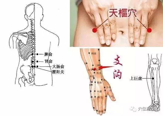 1,选穴:脾俞,大肠俞,支沟,天枢,上巨虚.