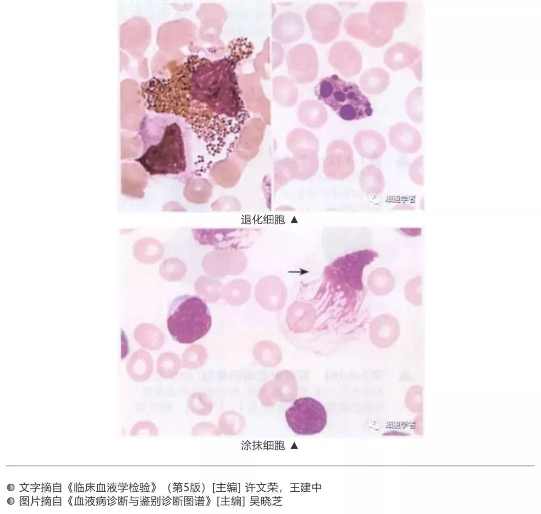 出自《血细胞图谱》[著] 三轮史朗(日)颗粒细胞电子显微镜下形态模