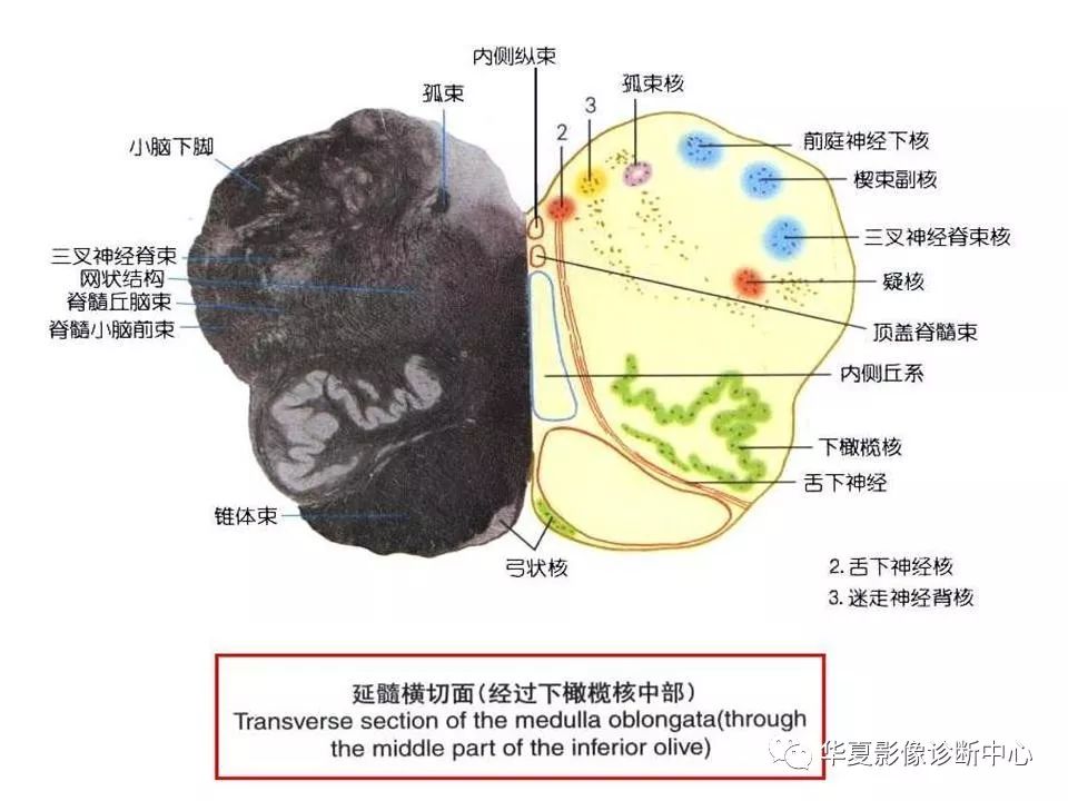 脑干的解剖与临床综合征