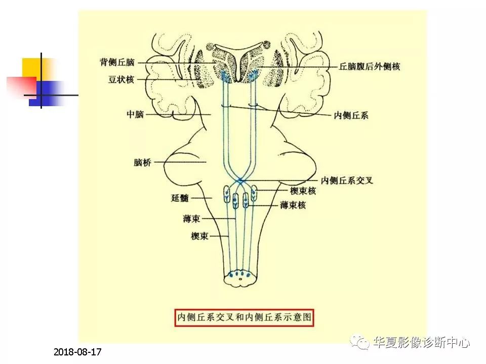 脑干的解剖与临床综合征