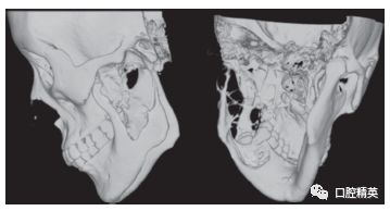 颌面部ct解剖图