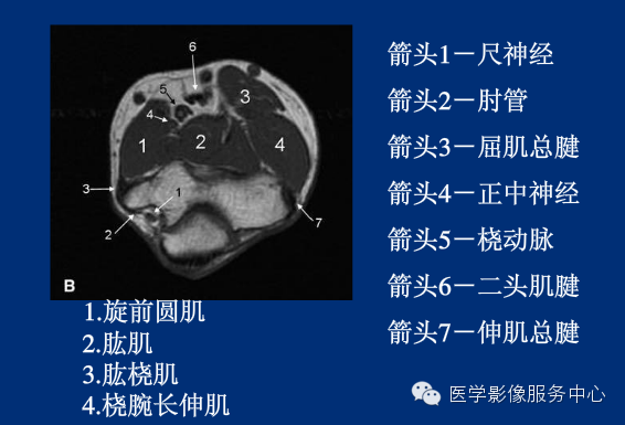 全身骨关节mri断层解剖大全