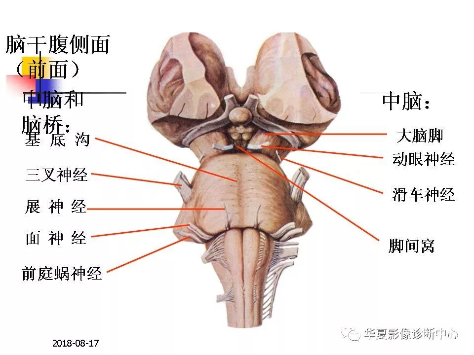 脑干的解剖与临床综合征