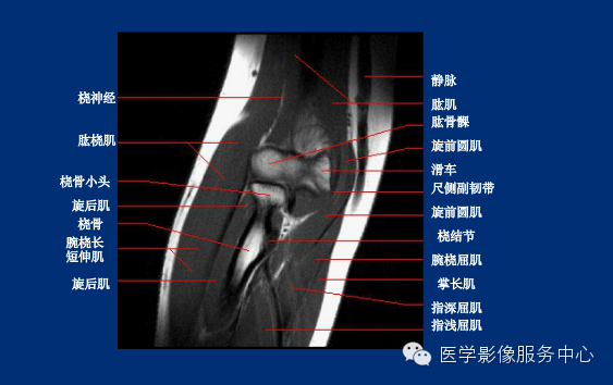 全身骨关节mri断层解剖大全