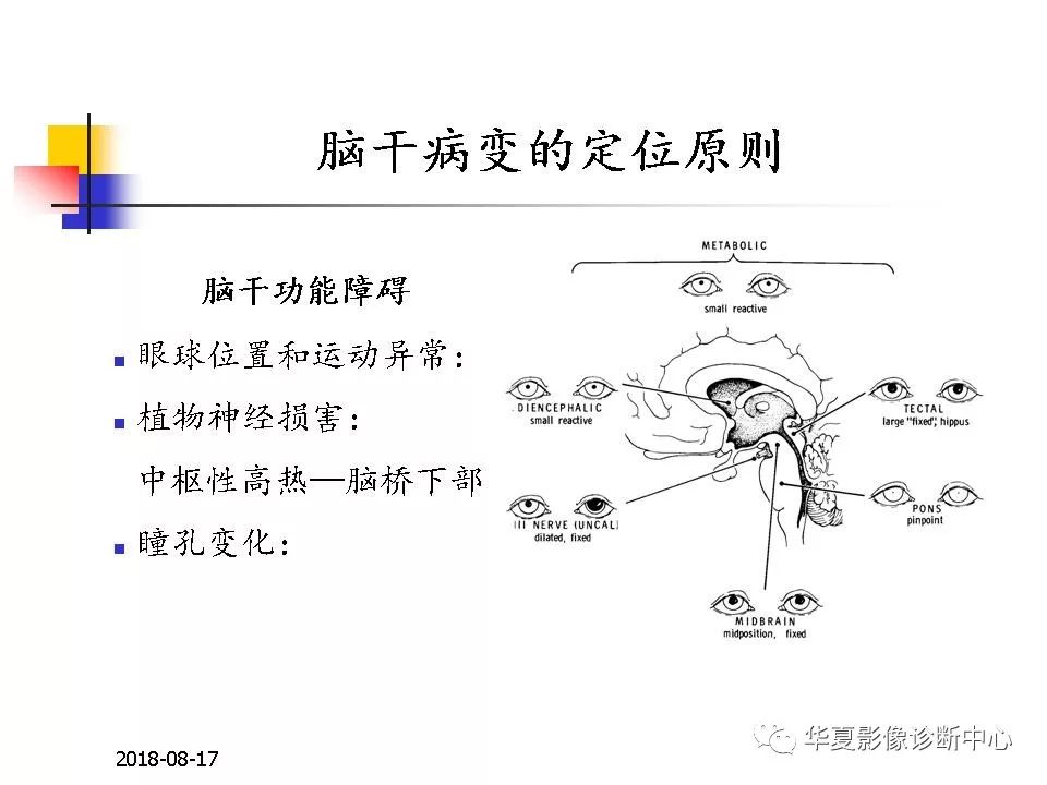 脑干的解剖与临床综合征