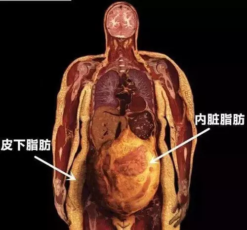 比外在肥胖更恐怖的是隐形肥做好5件事轻松远离