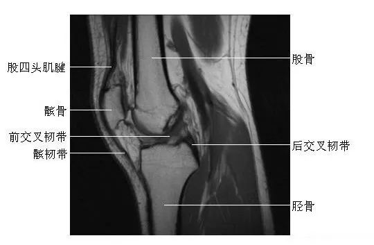 膝关节矢状面(2)