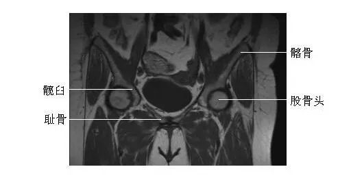 髋关节冠状面(2)