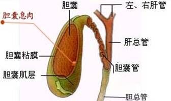 不知不觉癌变的胆囊息肉,是怎么回事?