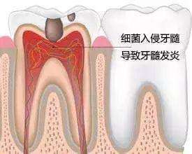 晚上睡觉牙齿痛怎么办