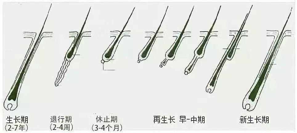 正常人一天脱落50-100根头发,然而也会有相应数目的头发长出来补充