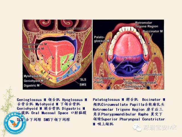 舌和口底影像解剖及临床病例