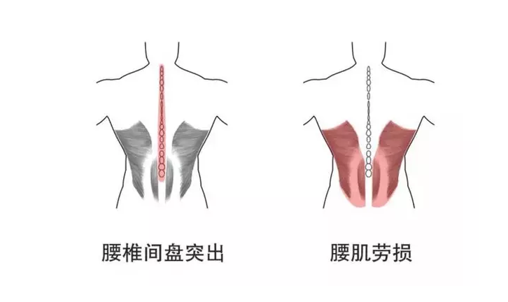 压痛点