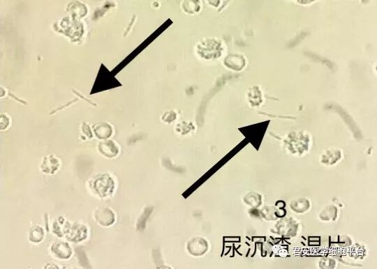 箭头指向的是什么?l 型细菌