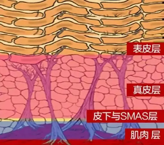 层拽着筋膜层,筋膜层拽着真皮层,真皮层里面含有弹性纤维以及胶原蛋白