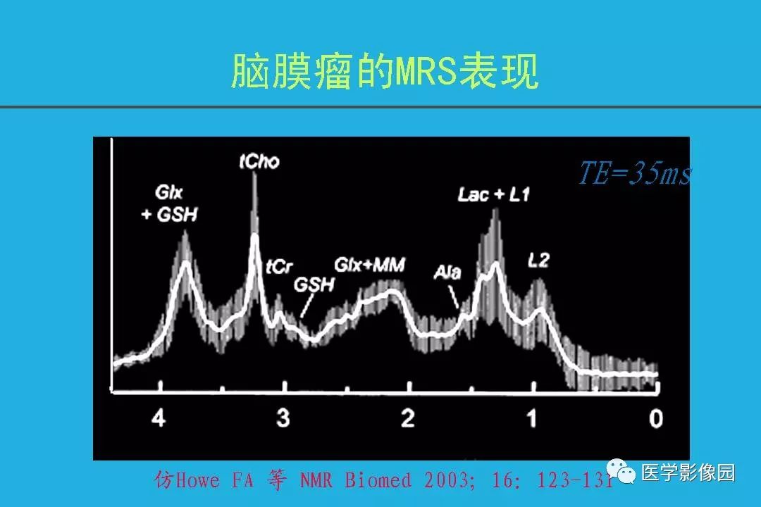 脑膜瘤的质子磁共振波谱分析影像天地